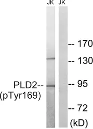Anti-Phospholipase D2 (phospho Tyr169) antibody used in Western Blot (WB). GTX55368