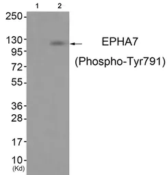 Anti-EphA7 (phospho Tyr791) antibody used in Western Blot (WB). GTX55377