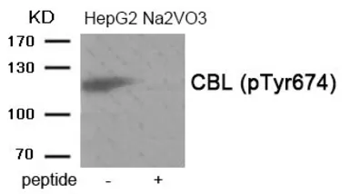 Anti-CBL (phospho Tyr674) antibody used in Western Blot (WB). GTX55390