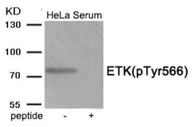 Anti-BMX (phospho Tyr566) antibody used in Western Blot (WB). GTX55393