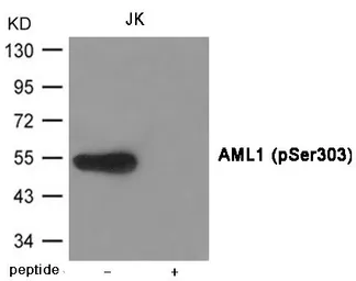 Anti-RUNX1 (phospho Ser303) antibody used in Western Blot (WB). GTX55410