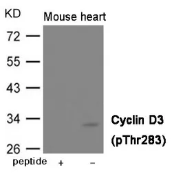 Anti-Cyclin D3 (phospho Thr283) antibody used in Western Blot (WB). GTX55411
