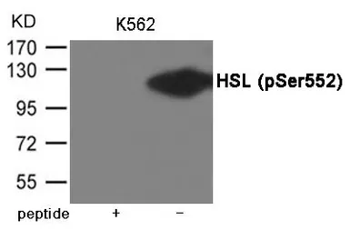 Anti-HSL (phospho Ser552) antibody used in Western Blot (WB). GTX55413