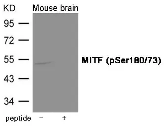 Anti-MITF (phospho Ser180/73) antibody used in Western Blot (WB). GTX55417