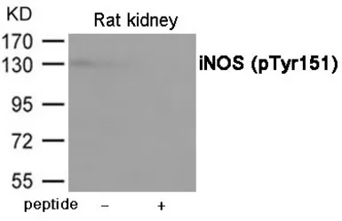Anti-iNOS (phospho Tyr151) antibody used in Western Blot (WB). GTX55433