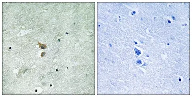 Anti-RIP2 (phospho Ser176) antibody used in IHC (Paraffin sections) (IHC-P). GTX55439