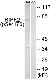 Anti-RIP2 (phospho Ser176) antibody used in Western Blot (WB). GTX55439