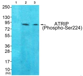 Anti-ATRIP (phospho Ser224) antibody used in Western Blot (WB). GTX55441