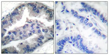 Anti-BIK (phospho Thr33) antibody used in IHC (Paraffin sections) (IHC-P). GTX55442