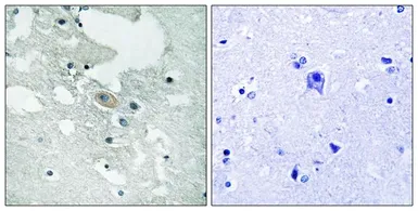 Anti-BLNK (phospho Tyr84) antibody used in IHC (Paraffin sections) (IHC-P). GTX55443