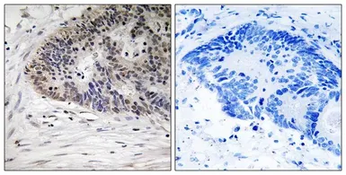 Anti-MDMX (phospho Ser367) antibody used in IHC (Paraffin sections) (IHC-P). GTX55445