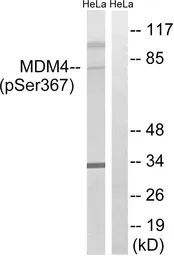 Anti-MDMX (phospho Ser367) antibody used in Western Blot (WB). GTX55445