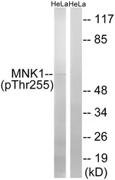 Anti-MNK1 (phospho Thr255) antibody used in Western Blot (WB). GTX55446