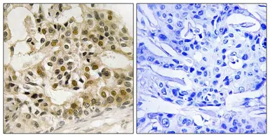 Anti-c-Myb (phospho Ser532) antibody used in IHC (Paraffin sections) (IHC-P). GTX55447