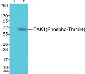 Anti-TAK1 (phospho Thr184) antibody used in Western Blot (WB). GTX55449