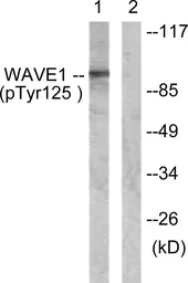 Anti-WAVE1 (phospho Tyr125) antibody used in Western Blot (WB). GTX55451