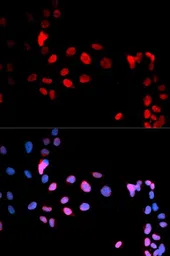 Anti-MAX (phospho Ser11) antibody used in Immunocytochemistry/ Immunofluorescence (ICC/IF). GTX55452