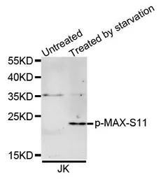 Anti-MAX (phospho Ser11) antibody used in Western Blot (WB). GTX55452