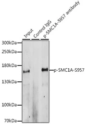 Anti-SMC1 (phospho Ser957) antibody used in Immunoprecipitation (IP). GTX55474