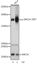 Anti-SMC1 (phospho Ser957) antibody used in Western Blot (WB). GTX55474