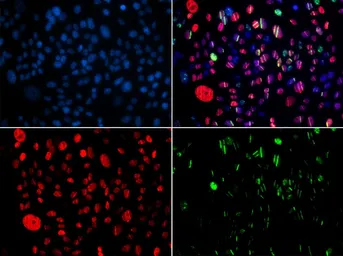 Anti-SMC1 (phospho Ser957) antibody used in Immunocytochemistry/ Immunofluorescence (ICC/IF). GTX55474