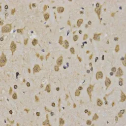 Anti-Histone H3K4me3 (Tri-methyl Lys4) antibody used in IHC (Paraffin sections) (IHC-P). GTX55482