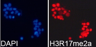 Anti-Histone H3R17me2 (di-methyl Arg17) antibody used in Immunocytochemistry/ Immunofluorescence (ICC/IF). GTX55484