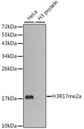 Anti-Histone H3R17me2 (di-methyl Arg17) antibody used in Western Blot (WB). GTX55484