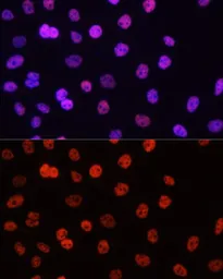 Anti-Histone H3R17me2 (di-methyl Arg17) antibody used in Immunocytochemistry/ Immunofluorescence (ICC/IF). GTX55484