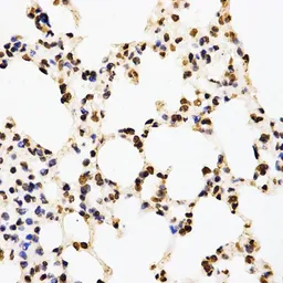 Anti-Histone H3R17me2 (di-methyl Arg17) antibody used in IHC (Paraffin sections) (IHC-P). GTX55484