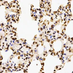 Anti-Histone H3R17me2 (di-methyl Arg17) antibody used in IHC (Paraffin sections) (IHC-P). GTX55484