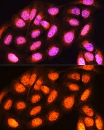 Anti-14-3-3 epsilon antibody used in Immunocytochemistry/ Immunofluorescence (ICC/IF). GTX55485