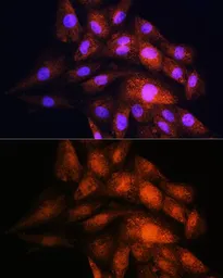 Anti-14-3-3 epsilon antibody used in Immunocytochemistry/ Immunofluorescence (ICC/IF). GTX55485