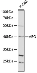 Anti-ABO antibody used in Western Blot (WB). GTX55487