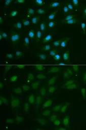Anti-ABO antibody used in Immunocytochemistry/ Immunofluorescence (ICC/IF). GTX55487