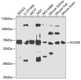 Anti-ACAD9 antibody used in Western Blot (WB). GTX55488