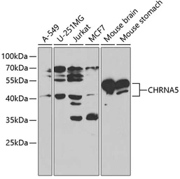 Anti-AChR alpha 5 antibody used in Western Blot (WB). GTX55490