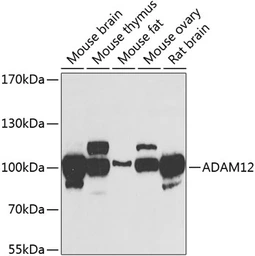 Anti-ADAM12 antibody used in Western Blot (WB). GTX55491