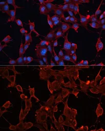 Anti-ADAM12 antibody used in Immunocytochemistry/ Immunofluorescence (ICC/IF). GTX55491