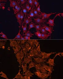 Anti-ADAM12 antibody used in Immunocytochemistry/ Immunofluorescence (ICC/IF). GTX55491