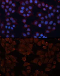 Anti-ADAM12 antibody used in Immunocytochemistry/ Immunofluorescence (ICC/IF). GTX55491