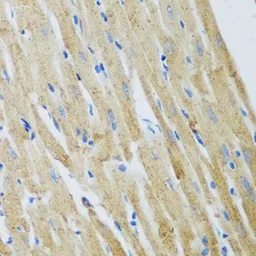 Anti-ADAM12 antibody used in IHC (Paraffin sections) (IHC-P). GTX55491