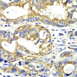 Anti-Adenylate kinase 2 antibody used in IHC (Paraffin sections) (IHC-P). GTX55493
