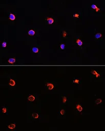 Anti-AIPL1 antibody used in Immunocytochemistry/ Immunofluorescence (ICC/IF). GTX55497