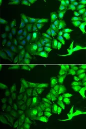 Anti-AIPL1 antibody used in Immunocytochemistry/ Immunofluorescence (ICC/IF). GTX55497