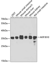 Anti-AKR1B10 antibody used in Western Blot (WB). GTX55498