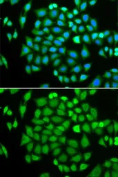 Anti-AKR7A2 antibody used in Immunocytochemistry/ Immunofluorescence (ICC/IF). GTX55500