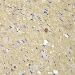 Anti-AKR7A2 antibody used in IHC (Paraffin sections) (IHC-P). GTX55500