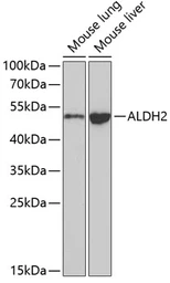 Anti-ALDH2 antibody used in Western Blot (WB). GTX55502