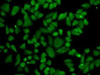 Anti-ALDH2 antibody used in Immunocytochemistry/ Immunofluorescence (ICC/IF). GTX55502